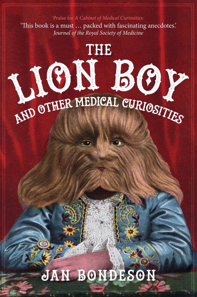 Le garçon lion et autres curiosités médicales